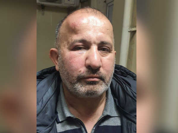 Ata və oğul "Azəriqaz"ın evə çağırdıqları əməkdaşını döyüblər? - <span class="color_red">FOTO</span>