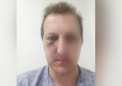 Xalq artistinin oğlunun döyülməsinə görə daha 2 şəxs saxlanıldı