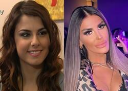 “Adanalı”nın Pınarı tanınmaz halda - <span class="color_red">FOTO</span>