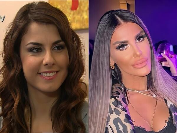 “Adanalı”nın Pınarı tanınmaz halda - <span class="color_red">FOTO</span>