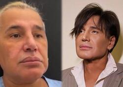 Samir Bağırov plastik əməliyyatdan əvvəl - Video