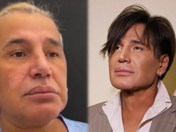 Samir Bağırov plastik əməliyyatdan əvvəl - Video