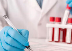 İİV/QİÇS barədə əhalinin məlumatlılığı artırılır – Erkən diaqnostika həyatı xilas edir