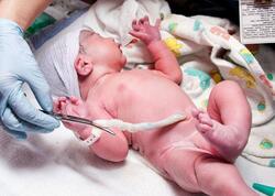 62 yaşlı türk müğənni özünü körpə göbəyi ilə CAVANLAŞDIRDI - <span class="color_red">FOTOlar</span>