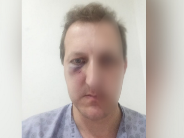 “Oğlumu qəddarlıqla döydülər” - Əməkdar artistdən oğlunu döyənlərin həbs edilməməsinə ETİRAZ