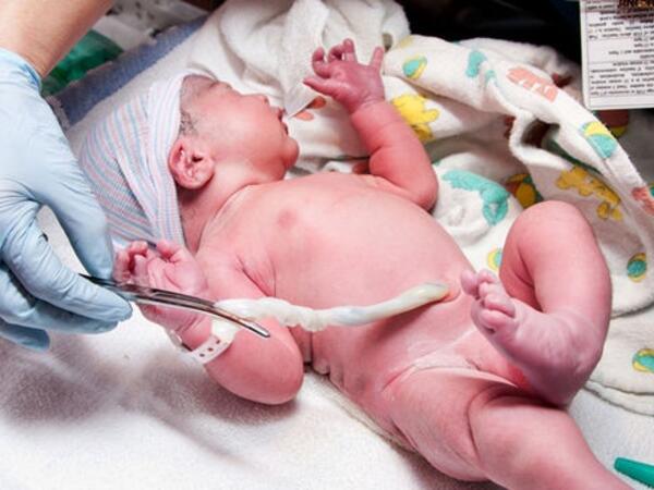 62 yaşlı türk müğənni özünü körpə göbəyi ilə CAVANLAŞDIRDI - <span class="color_red">FOTOlar</span>