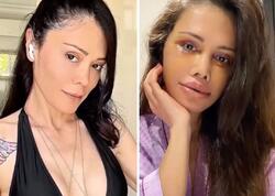 Əməliyyatla üzünü dəyişdirdi, tanınmaz hala düşdü - <span class="color_red">FOTO</span>