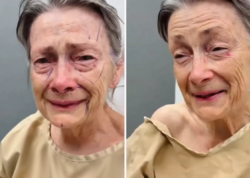 Estetik əməliyyatdan sonra inanılmaz dəyişim - <span class="color_red">VİDEO</span>