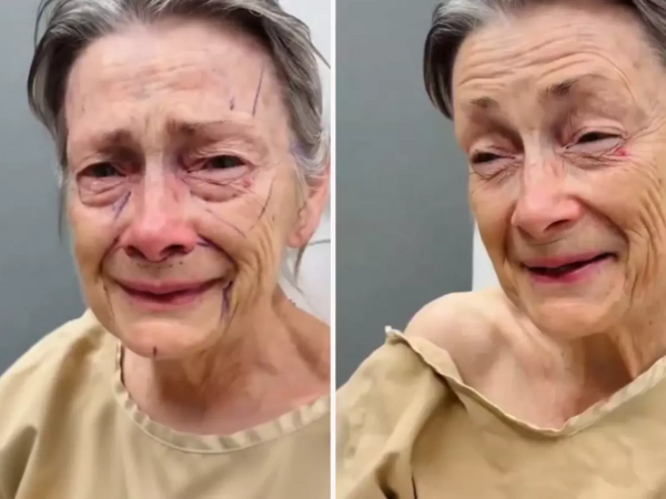 Estetik əməliyyatdan sonra inanılmaz dəyişim - <span class="color_red">VİDEO</span>