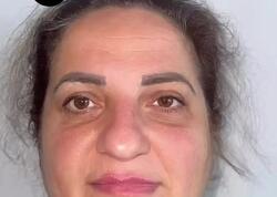 60 yaşlı qadın əməliyyatla 30 yaş CAVANLAŞDI - <span class="color_red">VİDEO</span>
