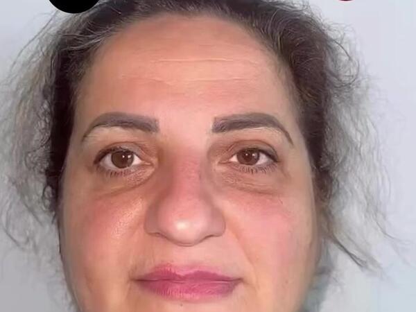 60 yaşlı qadın əməliyyatla 30 yaş CAVANLAŞDI - <span class="color_red">VİDEO</span>