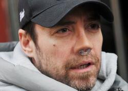 Məşhur müğənni 13-cü dəfə burun əməliyyatı keçirdi - <span class="color_red">FOTO</span>