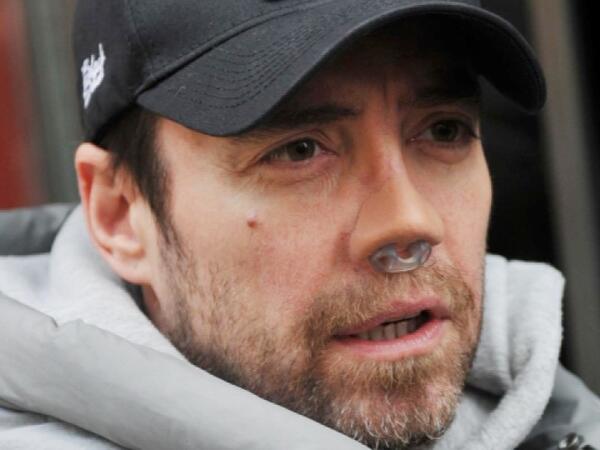 Məşhur müğənni 13-cü dəfə burun əməliyyatı keçirdi - <span class="color_red">FOTO</span>