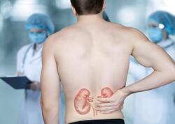 Bu qidalar böyrək daşı yaradır