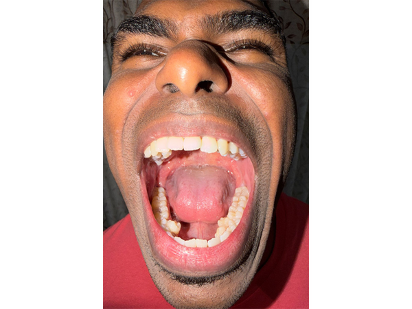Ağzında rekord sayda diş AŞKARLANDI - <span class="color_red">FOTO</span>
