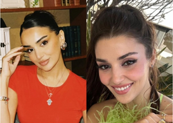 Bir-birinə bənzəyən MƏŞHURLAR: "Bir almanın 2 yarısı" - <span class="color_red">FOTOlar</span>