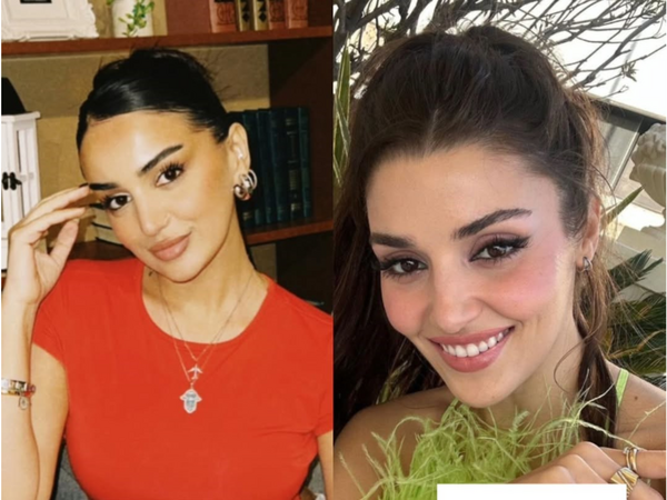 Bir-birinə bənzəyən MƏŞHURLAR: "Bir almanın 2 yarısı" - <span class="color_red">FOTOlar</span>