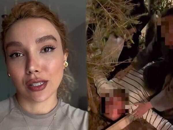 Üzel Kərimovanın rəfiqəsinin ərinə hücum EDİLDİ - 4 nəfər saxlanıldı - VİDEO