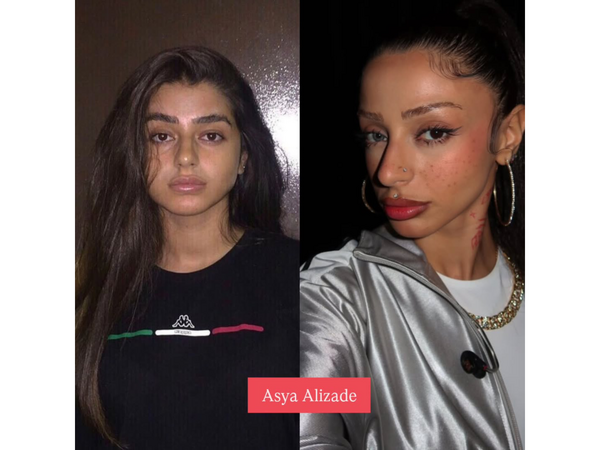 Azərbaycanlı məşhurların illər ərzində dəyişimi müzakirə yaratdı – Bəziləri TANINMAZ HALDA - <span class="color_red">FOTOlar</span>