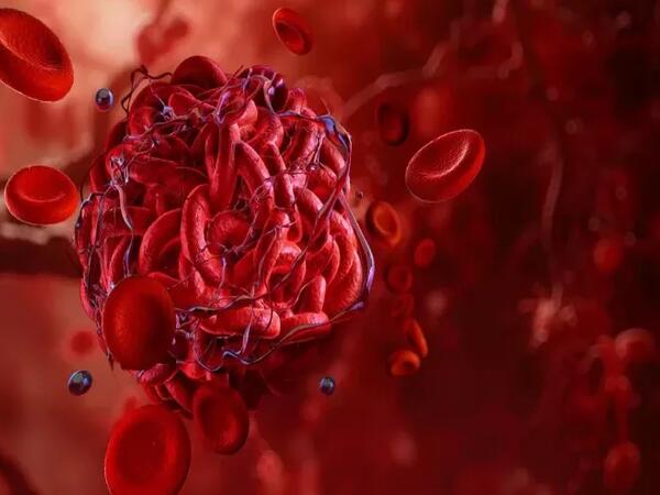 Tromb ola biləcəyini göstərən əsas narahatedici ƏLAMƏTLƏR