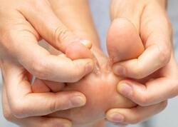 Ayaq və əllərdə göbələk varsa, belə edin