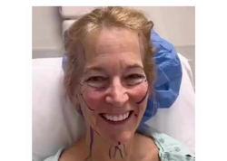 66 yaşlı qadın estetikdən sonra TANINMAZ HALDA – <span class="color_red">VİDEO</span>