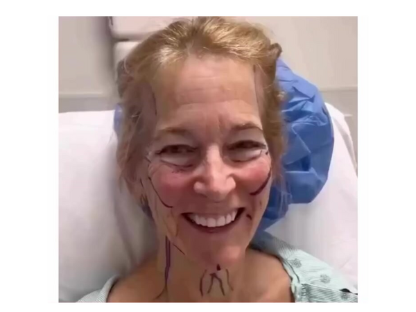 66 yaşlı qadın estetikdən sonra TANINMAZ HALDA – <span class="color_red">VİDEO</span>