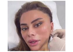 Daha bir məşhur estetik əməliyyat etdirdi, Röya görüb TANIMADI - <span class="color_red">VİDEO</span>