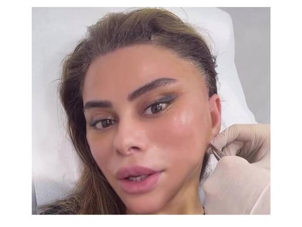 Daha bir məşhur estetik əməliyyat etdirdi, Röya görüb TANIMADI - <span class="color_red">VİDEO</span>