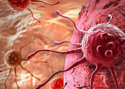 Xərçənglə bağlı çağırış