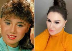 Estetik əməliyyatla dəyişən MƏŞHURLAR