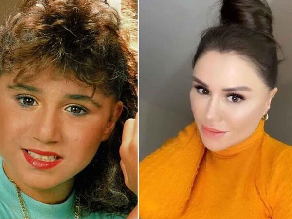 Estetik əməliyyatla dəyişən MƏŞHURLAR