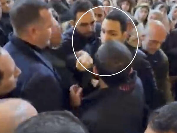 Paşinyana hücum edən gənc kəllə-beyin travması aldı