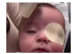 Əməliyyatdan sonra körpənin ilk dəfə anasını gördüyü ANLAR - <span class="color_red">VİDEO</span>