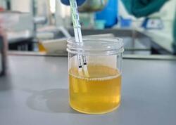 Bu 3 əlamətdən 2-si varsa, mütləq həkimə gedin