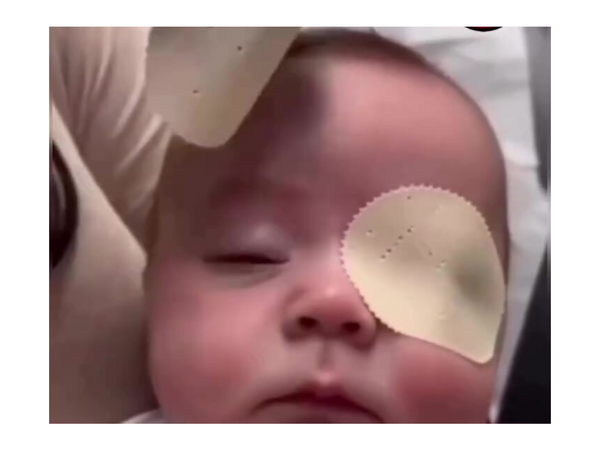 Əməliyyatdan sonra körpənin ilk dəfə anasını gördüyü ANLAR - <span class="color_red">VİDEO</span>