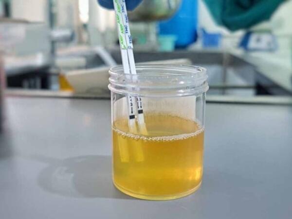 Bu 3 əlamətdən 2-si varsa, mütləq həkimə gedin