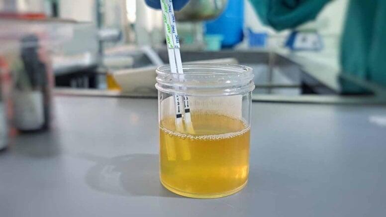 Bu 3 əlamətdən 2-si varsa, mütləq həkimə gedin