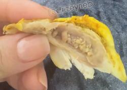 Toyuq ətində gizli TƏHLÜKƏ - Bu hissələri qətiyyən YEMƏYİN