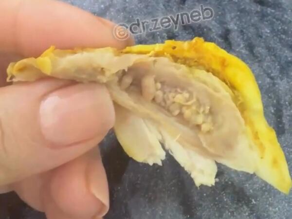 Toyuq ətində gizli TƏHLÜKƏ - Bu hissələri qətiyyən YEMƏYİN