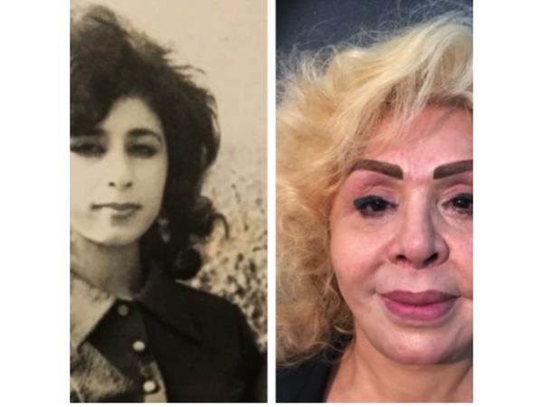 Müğənnilərin illər əvvəlki və indiki halı MÜZAKİRƏ YARATDI - <span class="color_red">FOTOlar</span>