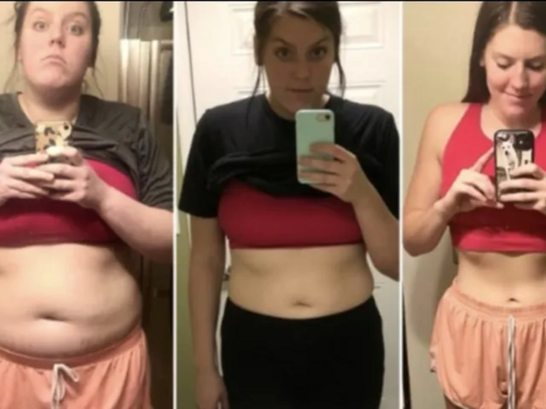 Sınamadığı üsul qalmamışdı - Bir ildə 32 kilo arıqladan 3 addım - <span class="color_red">FOTO</span>