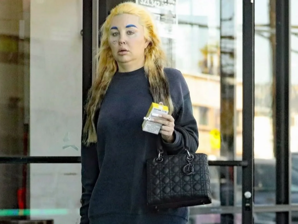 Məşhur aktrisa psixoloji xəstəlikdən sonra - <span class="color_red">FOTO</span>