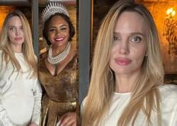 Colinin gözünə nə olub? - <span class="color_red">FOTO</span>