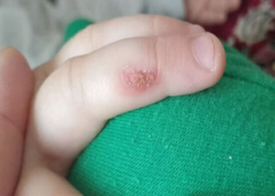 Bağçada müəllim bıçağı qızdıraraq uşağın əlinə xəsarət yetirib? - Rəsmi AÇIQLAMA