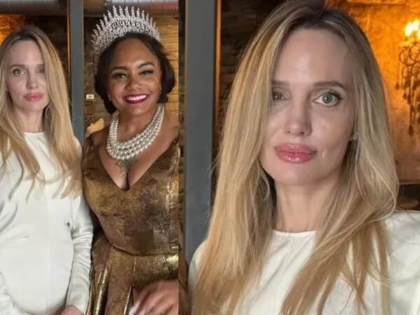 Colinin gözünə nə olub? - <span class="color_red">FOTO</span>