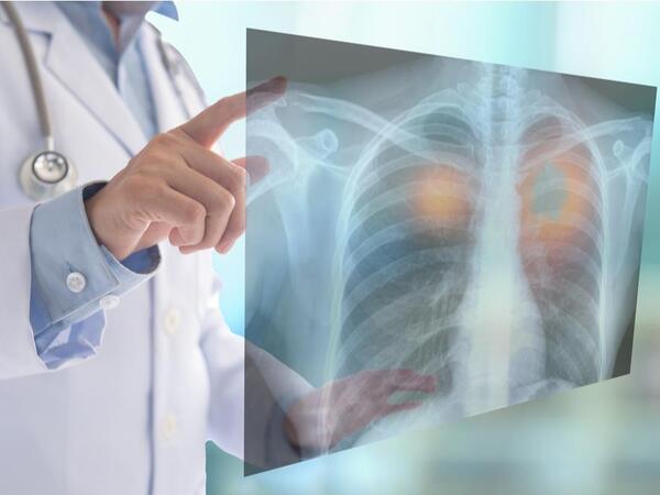 Zərərsiz görünən vərdişlər sağlamlıq üçün TƏHLÜKƏLİDİR