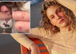 Farah Zeynep Abdullaha nə olub? - <span class="color_red">FOTO</span>