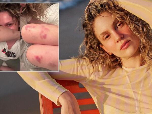 Farah Zeynep Abdullaha nə olub? - <span class="color_red">FOTO</span>