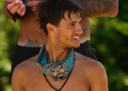 “Survivor”da dəhşətli hadisə: İştirakçının ayağı amputasiya edildi